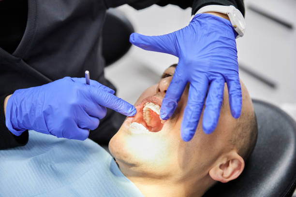 Best Emergency Dentist for Lost Fillings or Crowns in Corydon, IN