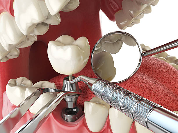 Best Emergency Dentist for Special Needs Patients in Corydon, IN