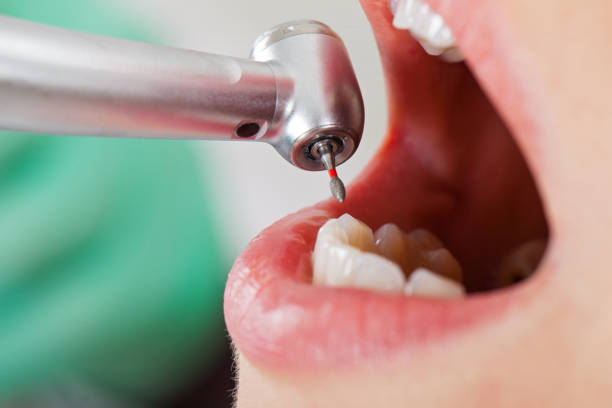 Best Emergency Cosmetic Dentistry in Corydon, IN